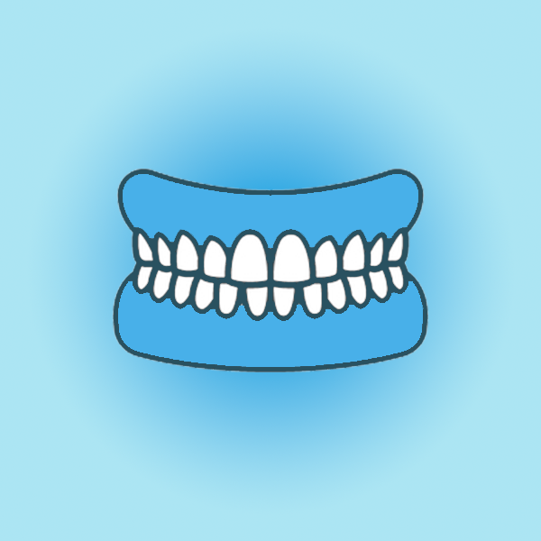 名古屋市名東区の 歯ぎしり・食いしばりの治療（ナイトガード）