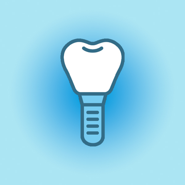 名古屋市名東区のインプラント治療