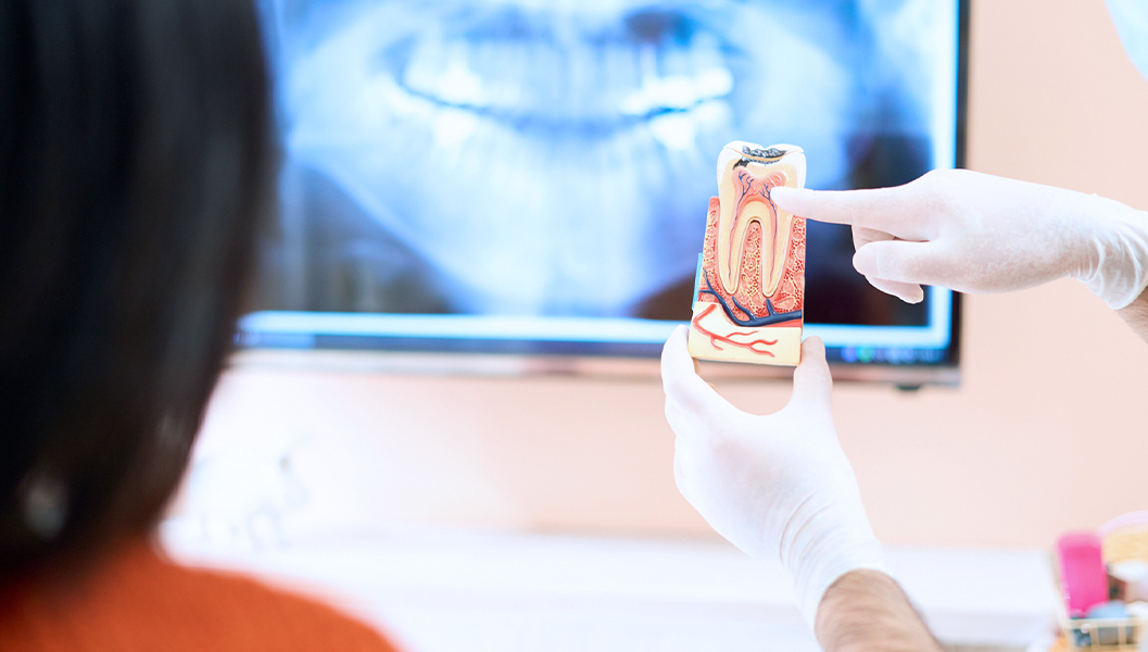 根尖病変（こんせんびょうへん）の診断