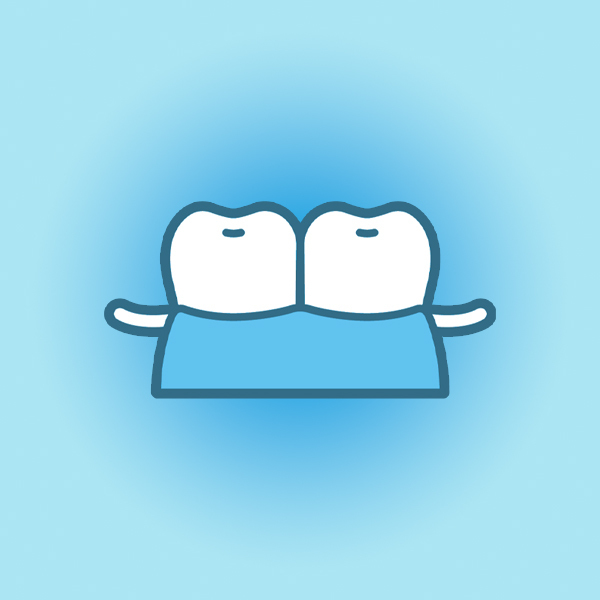 名古屋市名東区の入れ歯の治療