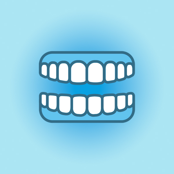 名古屋市名東区のガムブリーチ 