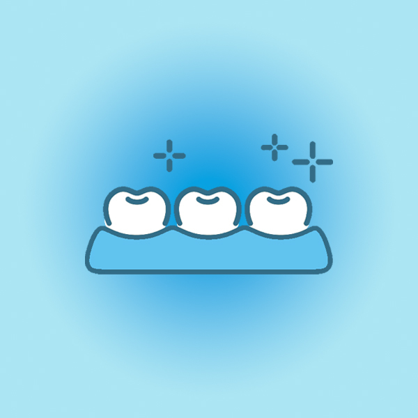 名古屋市名東区の審美歯科（白い詰め物・被せ物）、精度の高い被せ物