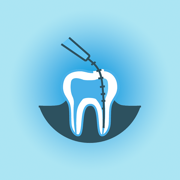 名古屋市名東区のホワイトニング 