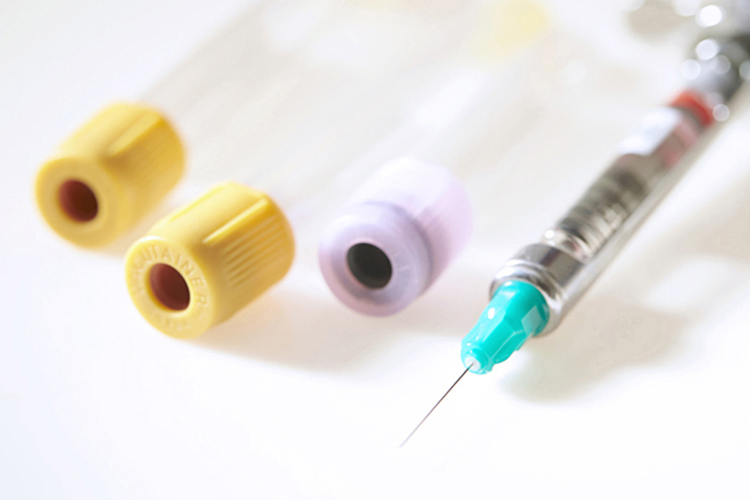 名古屋市名東区の虫歯の治療