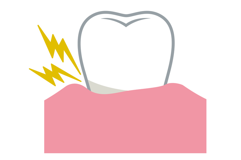 名古屋市名東区の自費の根管治療
